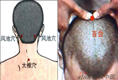 常見病艾灸時(shí)怎樣選穴?--大椎百會(huì)穴