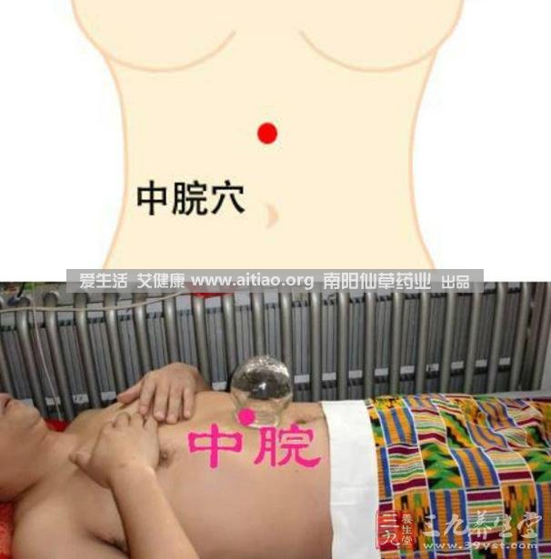 中脘穴位于腹部正中線，臍上4寸的位置上。每天艾灸10-15分鐘，能有效緩解胃部不適的癥狀，同時(shí)有助于祛濕。